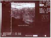 Ultrasonic scanning Mar 12, 2002